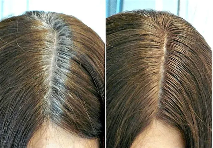 Лучшая краска для седых волос: топ-8 эффективных средств. Как покрасить седые волосы 28