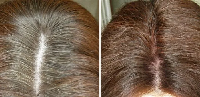 Лучшая краска для седых волос: топ-8 эффективных средств. Как покрасить седые волосы 21