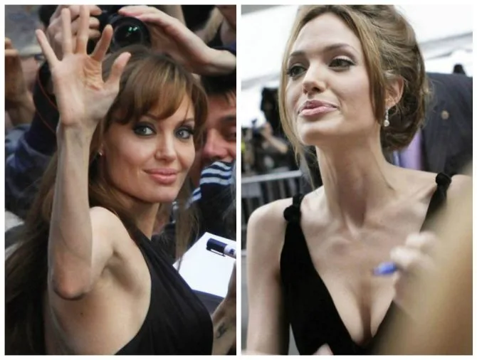Стройность или болезнь? Почему Анджелина Джоли похудела до 35 кг – ФОТО. Почему так сильно похудела анджелина джоли 2