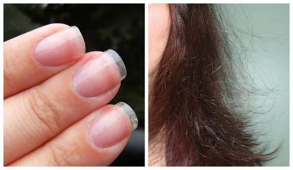 Тонкие ногти и волосы при синдроме истощения яичников