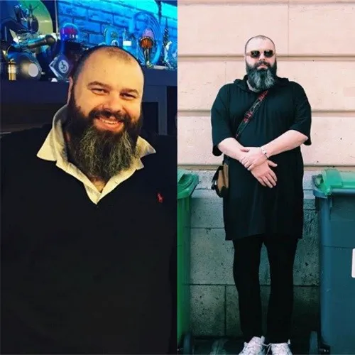 Максим Фадеев пробовал разные способы похудения