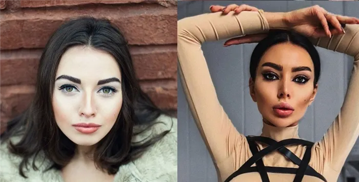 Алена Омович до и после пластики фото