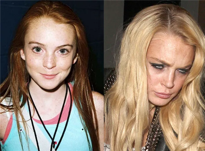 Российские и голливудские звезды до и после того, как они испортили свою внешность