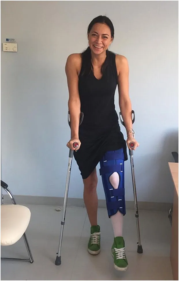 В шоу «Без страховки» Настасья повредила ногу