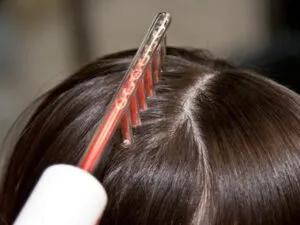 Основные причины выпадения волос. Почему волосы выпадают у женщин 2