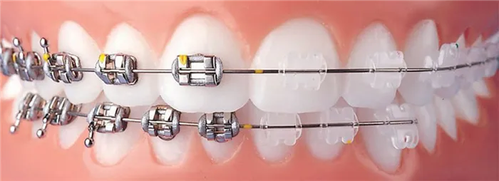 Почему услуги хороших стоматологов стоят дорого. Почему зубы такие дорогие 4