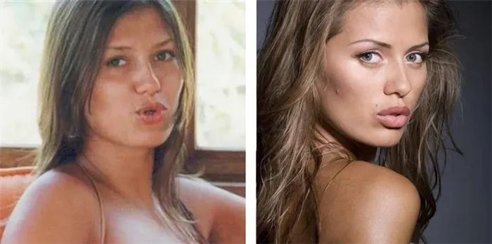 Виктория Боня до и после пластической операции