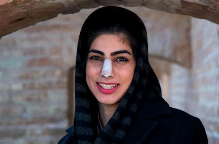Красота и престиж иранских женщин, как это ни парадоксально, ограничиваются их носами. /Фото: facte.ru
