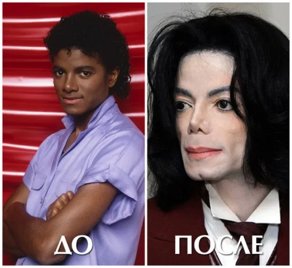 От идола до «монстра». Трагедии и тайны Майкла Джексона. Почему майкл джексон носил маску 24