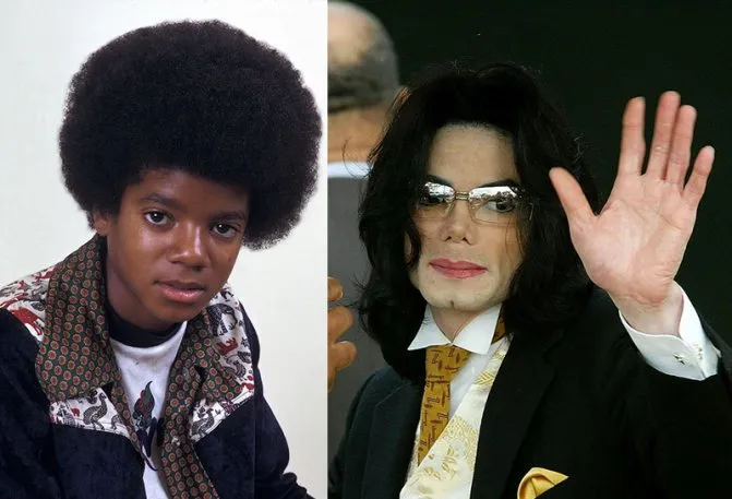 От идола до «монстра». Трагедии и тайны Майкла Джексона. Почему майкл джексон носил маску 4