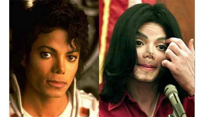 От идола до «монстра». Трагедии и тайны Майкла Джексона. Почему майкл джексон носил маску 26