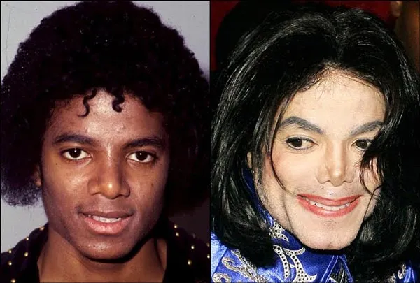 От идола до «монстра». Трагедии и тайны Майкла Джексона. Почему майкл джексон носил маску 6