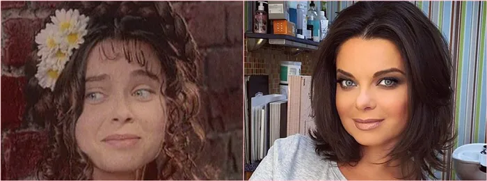 Наташа Королёва до и после пластической операции