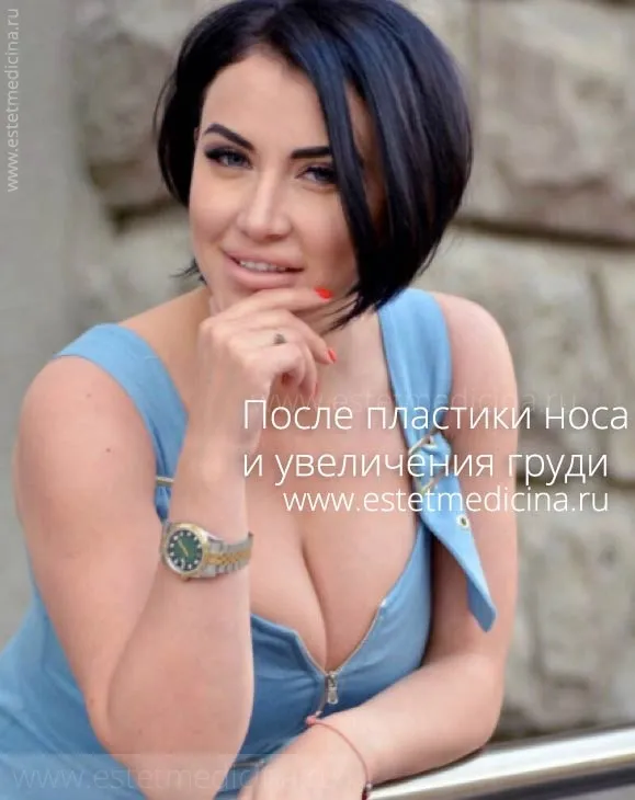 Увеличение груди ViktoriaBernikova