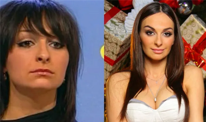 Екатерина Варнава до и после пластической операции