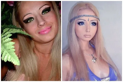 Валерия Луканова до и после операции. Фотографии Barbie Girls в Instagram (Amatue), вконтакте.