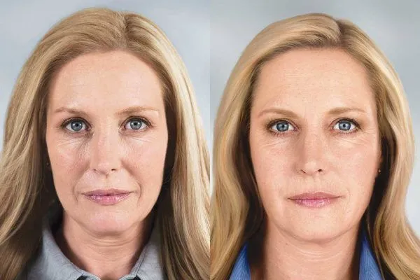 Минус 10 лет точно: хитрости макияжа для дам за 50, которые помогут скрыть морщины и замаскировать желтоватую кожу. Как скрыть морщины косметикой? 2