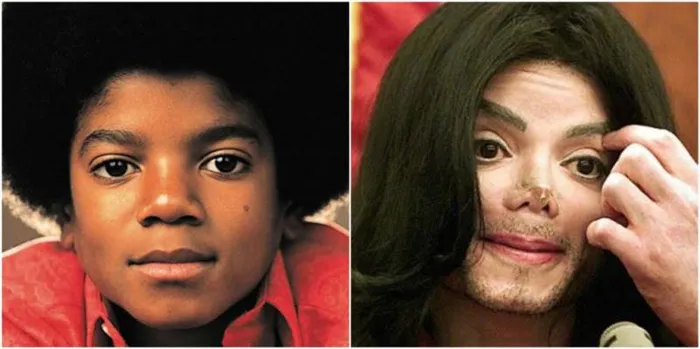 Почему Майкл Джексон стал белым? Ответ на вопрос и интересные факты. Как майкл джексон стал белым? 3