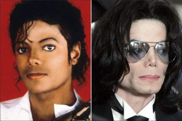 Почему Майкл Джексон стал белым? Ответ на вопрос и интересные факты. Как майкл джексон стал белым? 2