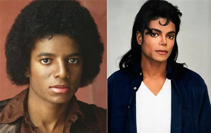 Почему Майкл Джексон стал белым? Ответ на вопрос и интересные факты. Как майкл джексон стал белым? 4