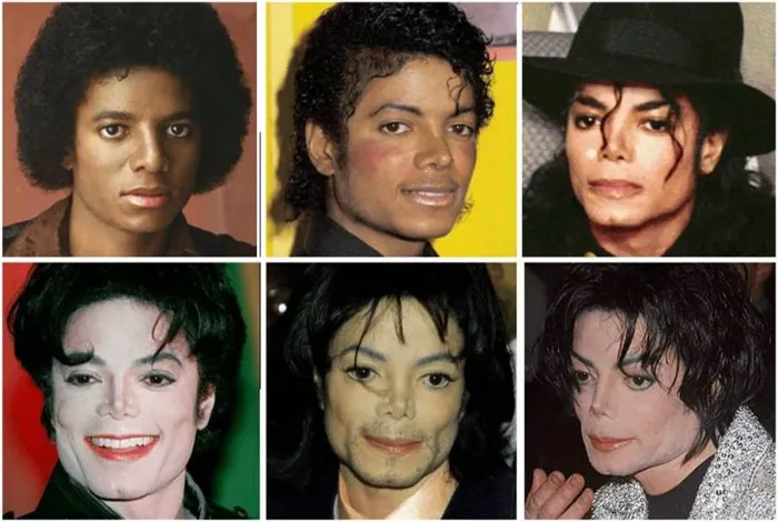 Почему Майкл Джексон стал белым? Ответ на вопрос и интересные факты. Как майкл джексон стал белым? 5