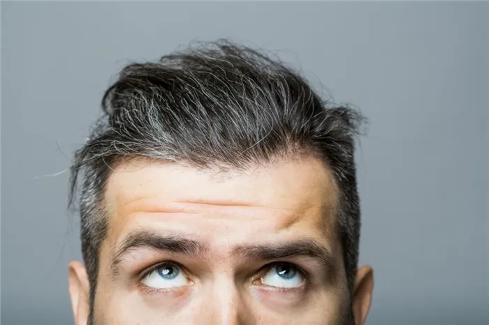 Выпадение волос: финастерид, лазер или миноксидил — что действительно поможет мужчинам и женщинам восстановить потерянные волосы на голове. Какие таблетки для роста волос? 2