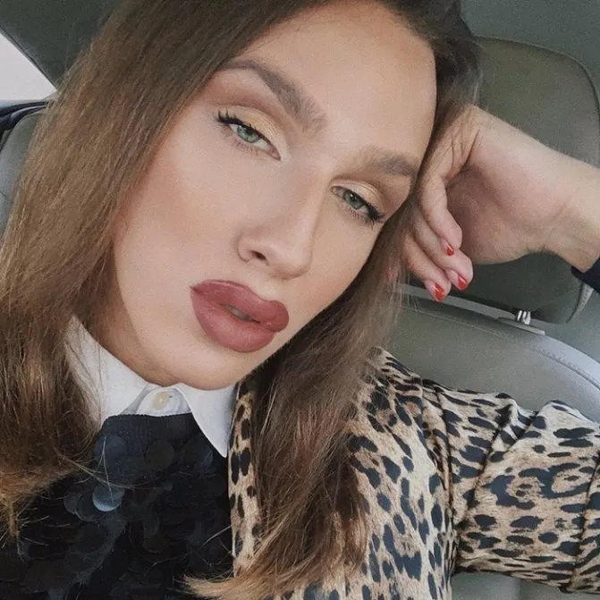 Алексей Жидовский до и после пластики Фото и Видео. Алексей жидковский кто это? 6