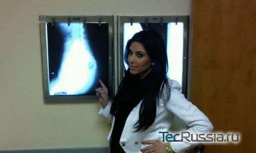Ким Кардашян и рентгеновский снимок ее ягодиц