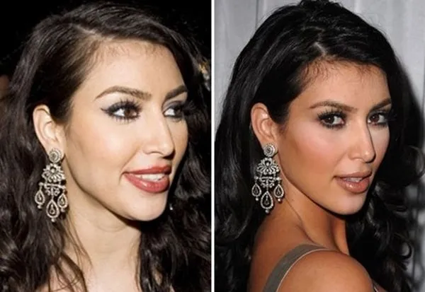 Ким Кардашьян до и после пластики носа