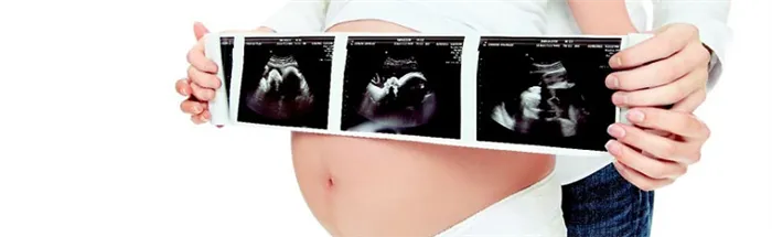 Фото результата УЗИ диагностики срока беременности