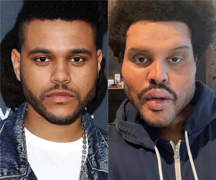 Певец The Weeknd показал свое «прежнее» лицо после изменений, имитирующих пластическую операцию