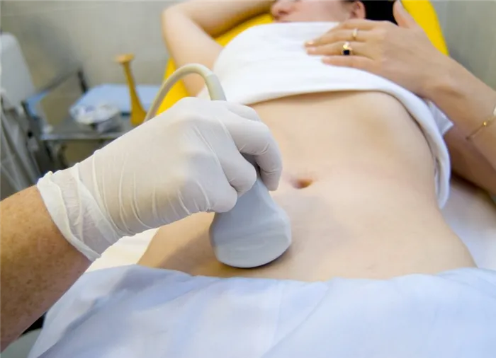 Полипы в матке: диагностика и лечение. Что у женщин под плавками фото? 6