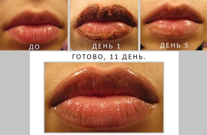 Перманентный макияж губ: как выполняется и сколько держится. Как делают перманентный макияж губ видео. 13