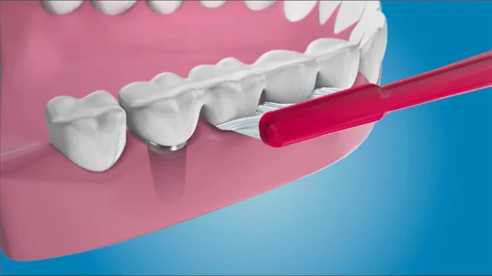Уход за съемными зубными протезами из пластмассы 