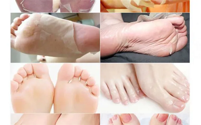 Фото: красивый педикюр пальцев ног