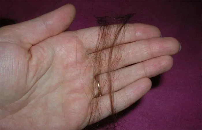 А вы знаете на сколько см вырастают волосы за месяц? От чего вообще зависит скорость роста и можно ли ускорить отрастание. На сколько см вырастают волосы за месяц. 3