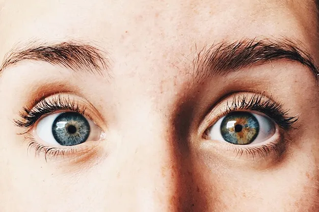 виды гетерохромии глаз