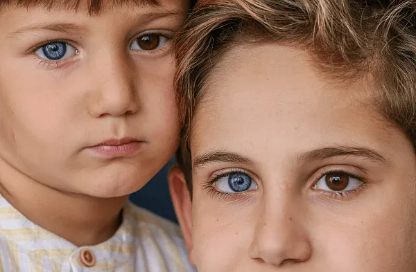 Гетерохромия: глаза разного цвета. Разный цвет глаз как называется у людей. 5