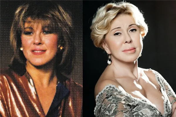 Фото Любови Успенской (певица) до и после пластики