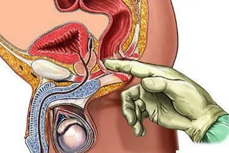 Массаж простаты пальцем