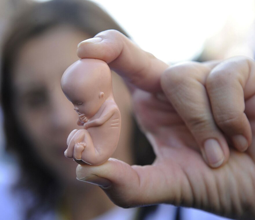Бесплодие после аборта: какова вероятность осложнения. Куда девают детей после аборта? 1