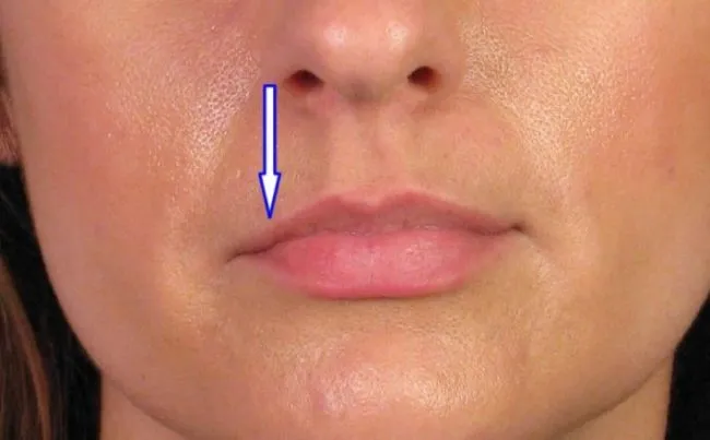 Определение характера человека — Форма губ. Какие у тебя губы 3