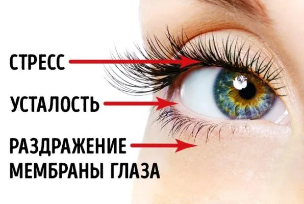 Дергается глаз – что делать? Причины и лечение подергивания глаз. Блефароспазм. Что делать глаз дергается 3