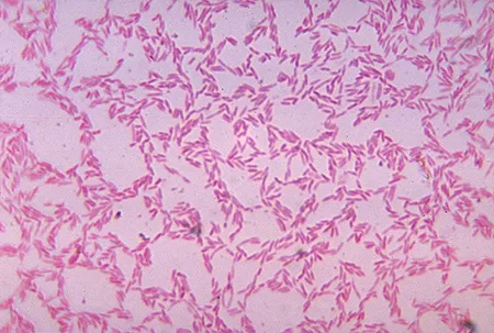 Bacteroides (бактероиды, род бактерий). Энтеротипы человека как определить 33