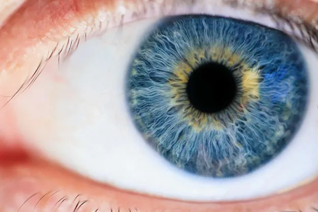 Гетерохромия глаз – красота или болезнь. Как называется когда глаза разного цвета. 4