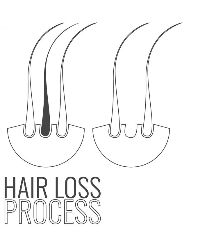 Как сделать тонкие волосы объемными: что изменить в уходе и какими средствами пользоваться. Как восстановить объем волос. 32