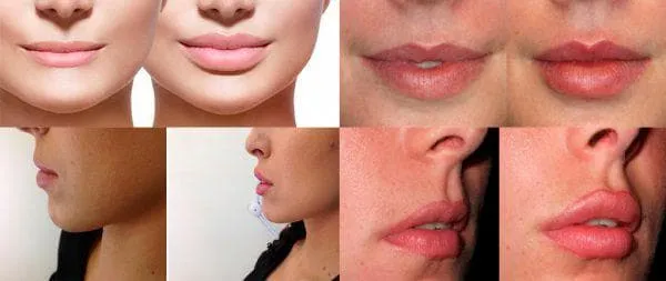 Перманентный макияж губ: как выполняется и сколько держится. Как делают перманентный макияж губ видео. 6