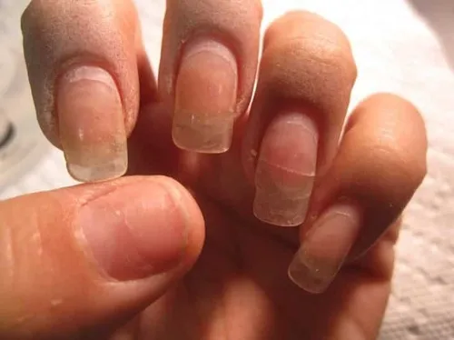 Как восстановить ногти после гель-лака. Как восстановить ногти после гель лака. 43