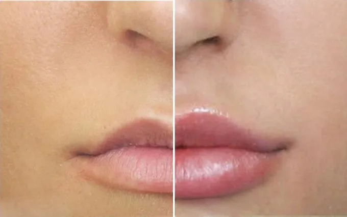 5 способов увлажнить сухую кожу губ. Что значит увлажнять губы. 47