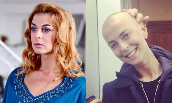 Здоровье ценнее всего или что сейчас известно о 6 российских актрисах, борющихся с онкологией. Кто из артистов болен раком сейчас. 48